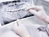 Respuesta de las células microgliales a la enfermedad periodontal 