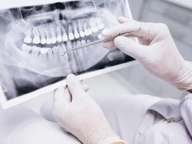 Respuesta de las células microgliales a la enfermedad periodontal 