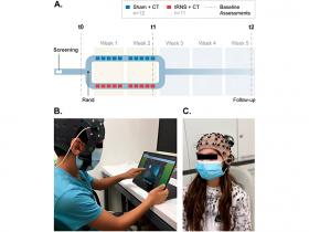 Procedimiento no invasivo de estimulación cerebral en TDAH puede aliviar los síntomas