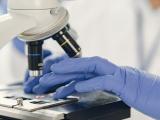Resistencia a los antimicrobianos amenaza a los 35 países de las Américas 