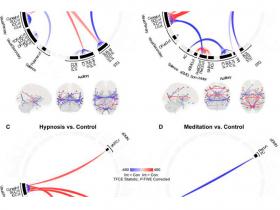 Correlatos neuronales de la conciencia: de los psicodélicos a la hipnosis y la meditación