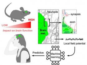Aprendizaje automático identifica subtipos de metástasis cerebrales 