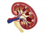 Deep learning revela heterogeneidad tumoral en distintos estados de cáncer de riñón