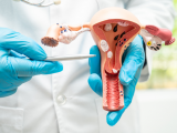 Alimentación cetogénica para la salud reproductiva femenina
