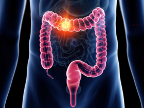 Consumo de vegetales previene cáncer gastrointestinal