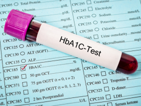 Influencia del género en el subdiagnóstico de diabetes