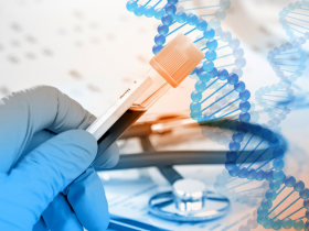 Biopsias líquidas para el monitoreo de cáncer de mama