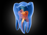 Enfermedades autoinmunes afectan el desarrollo dental