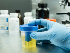 Biomarcadores urinarios revelan la salud renal y cardiometabólica