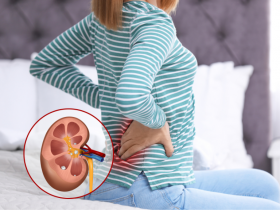 Obesidad en adolescentes generaría problemas renales