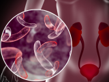 Antibióticos efectivos contra infecciones urinarias por bacterias multirresistentes