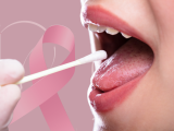 Test de saliva para la detección temprana del cáncer de mama