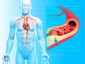 Micro y nanoplásticos como factores de riesgo cardiovascular