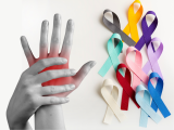 Artritis reumatoide se asocia a varios cánceres