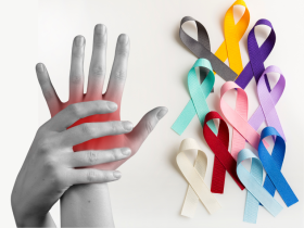 Artritis reumatoide se asocia a varios cánceres