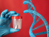 ADN en heces para la detección oportuna de cáncer colorrectal