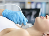 Alternativa terapéutica para el cáncer de tiroides