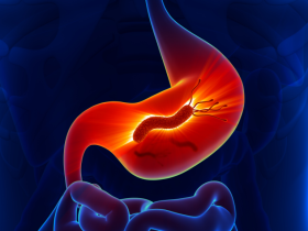 Tratamiento de erradicación efectivo frente a H. pylori
