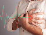 Efectos cardiovasculares del colesterol HDL como terapia