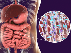 Trasplante de heces: alternativa para tratar la disbiosis intestinal