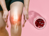 Aceite de krill no alivia el dolor en la osteoartritis de rodilla