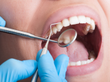 Conexión entre la salud tiroidea y periodontal