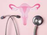Eficacia de un anticuerpo-fármaco en el tratamiento del cáncer de cuello uterino