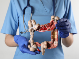 Ventajas terapéuticas de risankizumab en la colitis ulcerosa