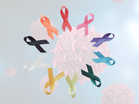 Agonistas del GLP-1 disminuyen riesgo de cáncer en diabéticos