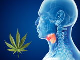 Consumo de cannabis se asocia a cáncer de cabeza y cuello