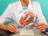 Estrategia innovadora para prevenir el cáncer gástrico