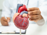 Impacto cardiovascular de los ultraprocesados