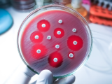 Resistencia a los antimicrobianos: una carrera contra el tiempo