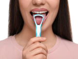 Bacterias bucales asociadas al cáncer de cabeza y cuello
