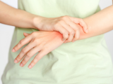 Vínculo entre la disbiosis intestinal y la artritis reumatoide