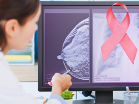 Optimización del tratamiento del cáncer de mama triple negativo