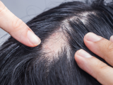 Huellas dermatológicas de la COVID-19