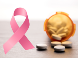 Ácido acetilsalicílico reduciría mortalidad por cáncer de mama