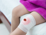 Efectividad de los analgésicos en el alivio del dolor agudo pediátrico