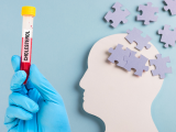 Colesterol como predictor clave de demencia
