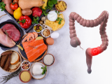 Dieta mediterránea reduce riesgo de cánceres relacionados con la obesidad