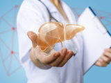 Enfoques integrales para combatir la esteatosis hepática no alcohólica