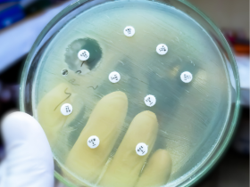 Llamado urgente a la acción contra la resistencia antimicrobiana