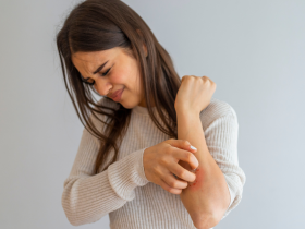 Dermatitis atópica y TDAH requieren enfoques integrados