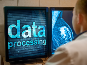 Optimización de la detección temprana del cáncer de mama con IA
