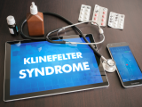 El vínculo entre el síndrome de Klinefelter y el TDAH