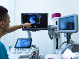Calcificaciones mamográficas aumentan el riesgo de cáncer de mama avanzado