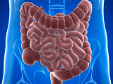 Rol de la barrera intestinal en las enfermedades crónicas