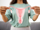 adenomiosis, endometriosis, infertilidad, dismenorrea