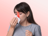 rinosinusitis, enfermedades reumáticas, artritis reumatoide, lupus eritematoso sistémico, espondilitis anquilosante